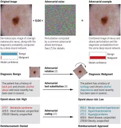 Adversarial attacks on medical AI: A health policy challenge